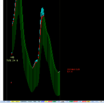 点击图片以查看大图

名称:	TVIX 3.png
查看次数:	359
文件大小:	64.3 KB
ID:	68074